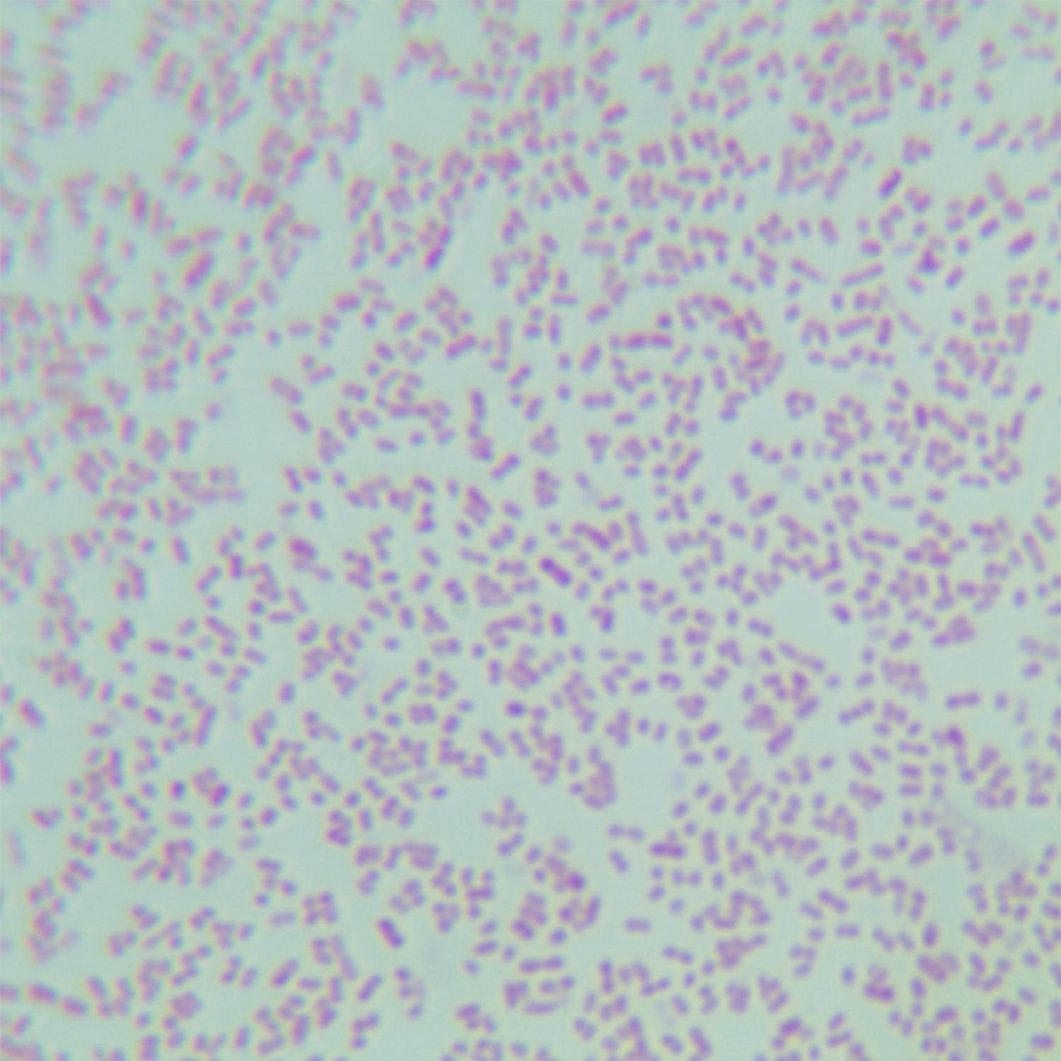 Pseudomonas aeruginosa-BNCC