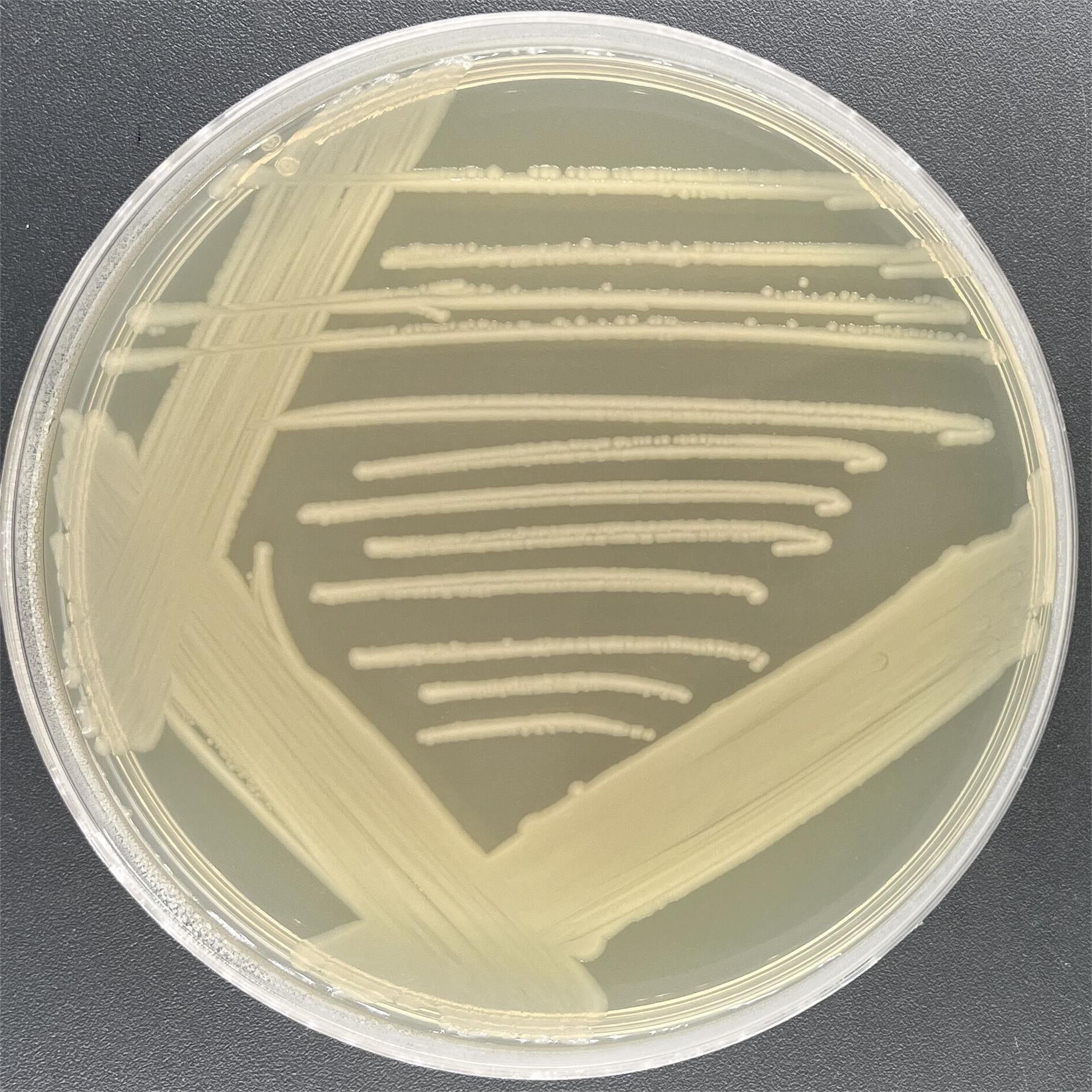 Escherichia coli (E. coli)-BNCC