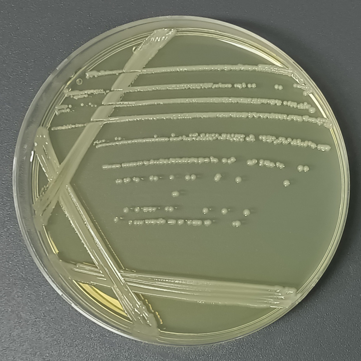 Escherichia coli-BNCC