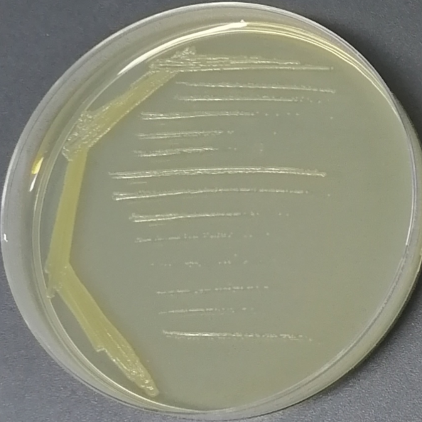 Bacillus lipolyticus-BNCC