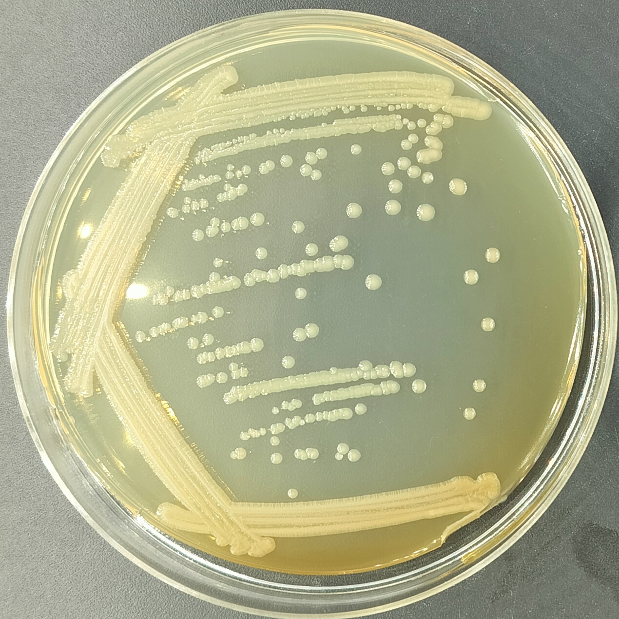 Shigella flexneri-BNCC
