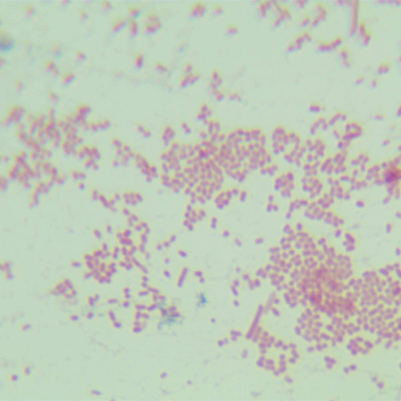Shigella flexneri-BNCC