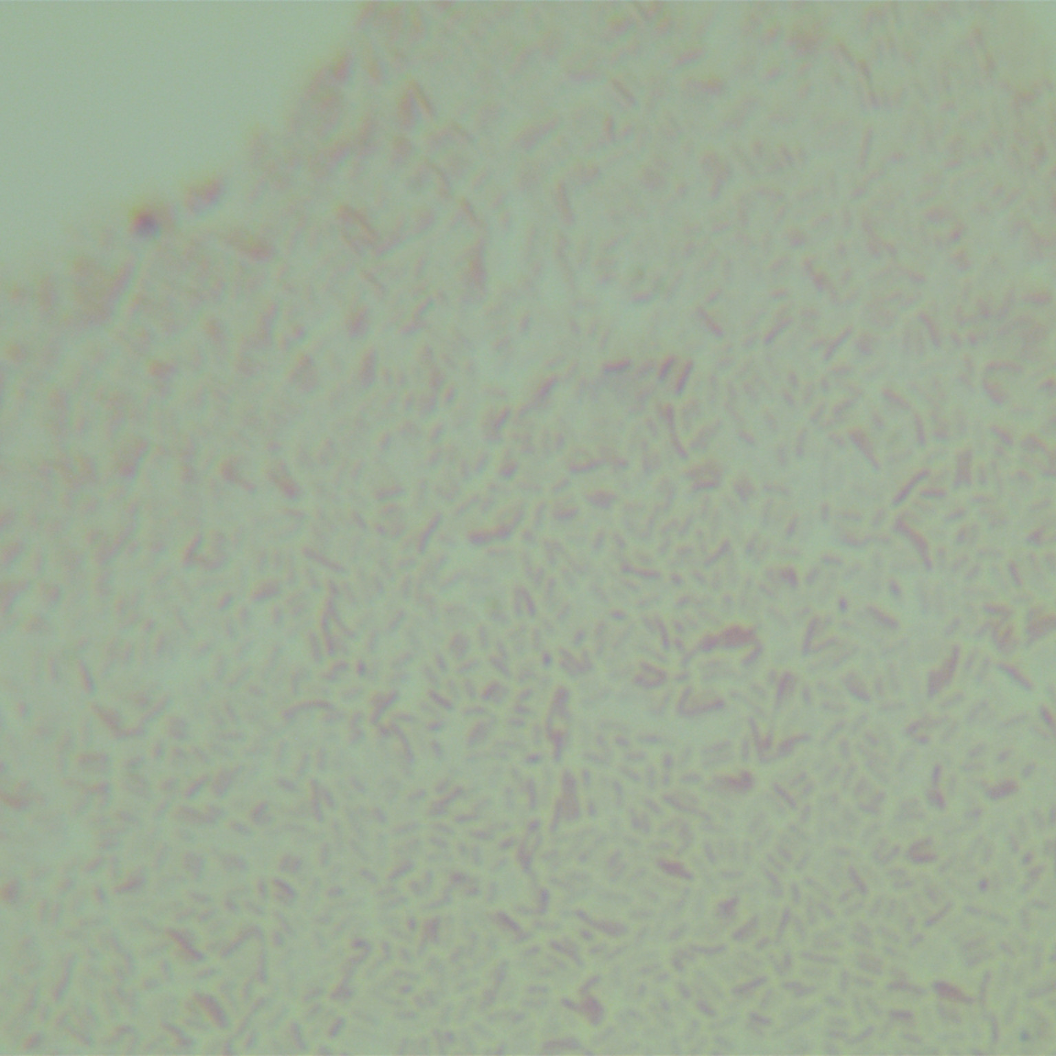 Pseudomonas aeruginosa-BNCC