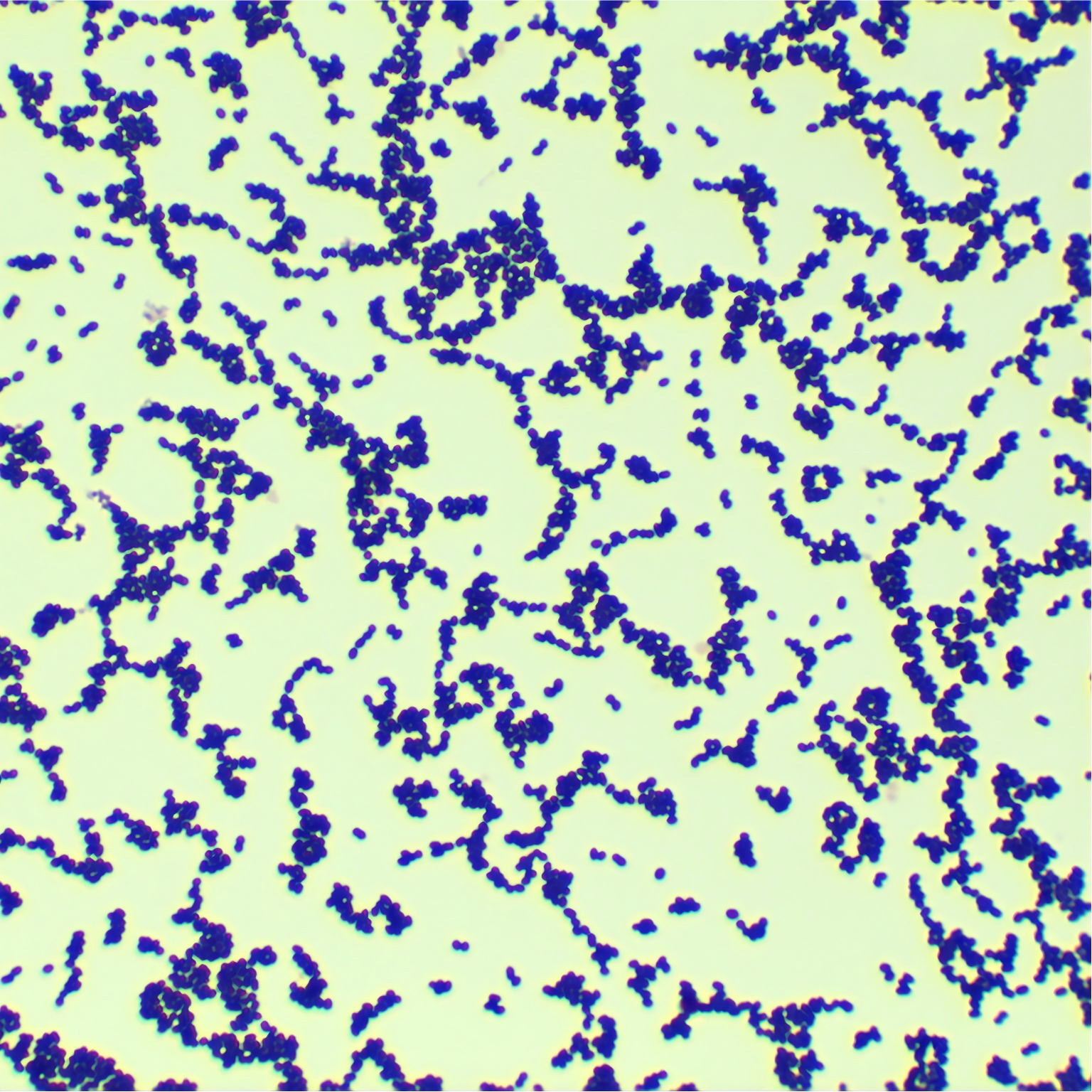 Enterococcus faecalis (Enterococcus faecalis)-BNCC