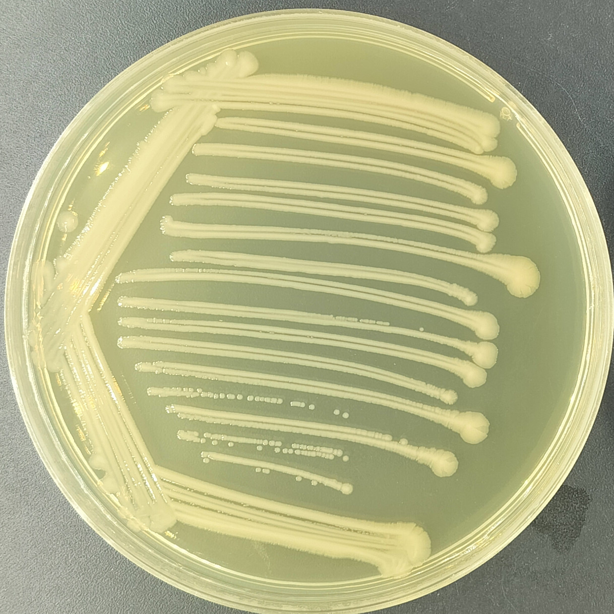 Escherichia coli-BNCC