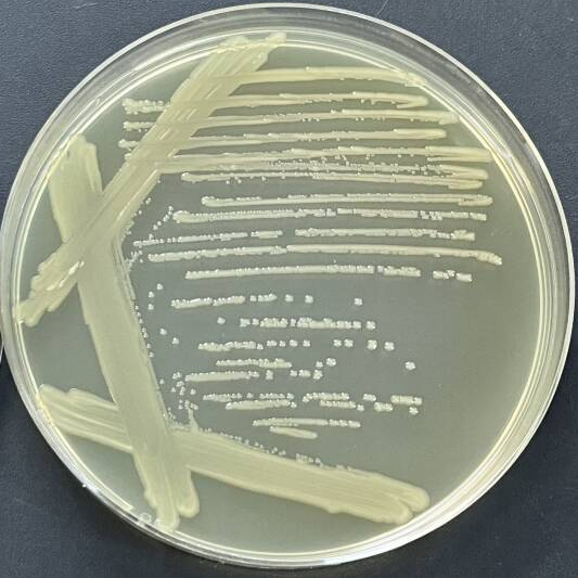 Enterotoxigenic Escherichia coli-BNCC