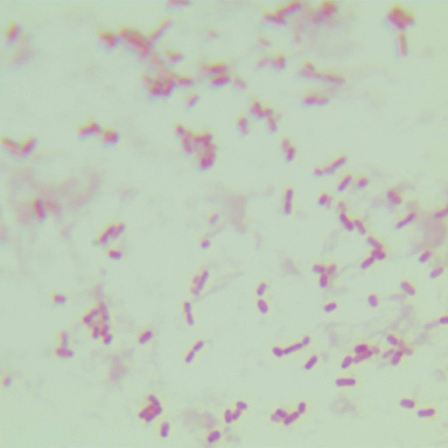 Enterotoxigenic Escherichia coli-BNCC