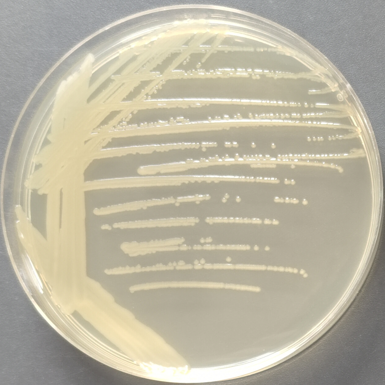 Vibrio vulnificus-BNCC
