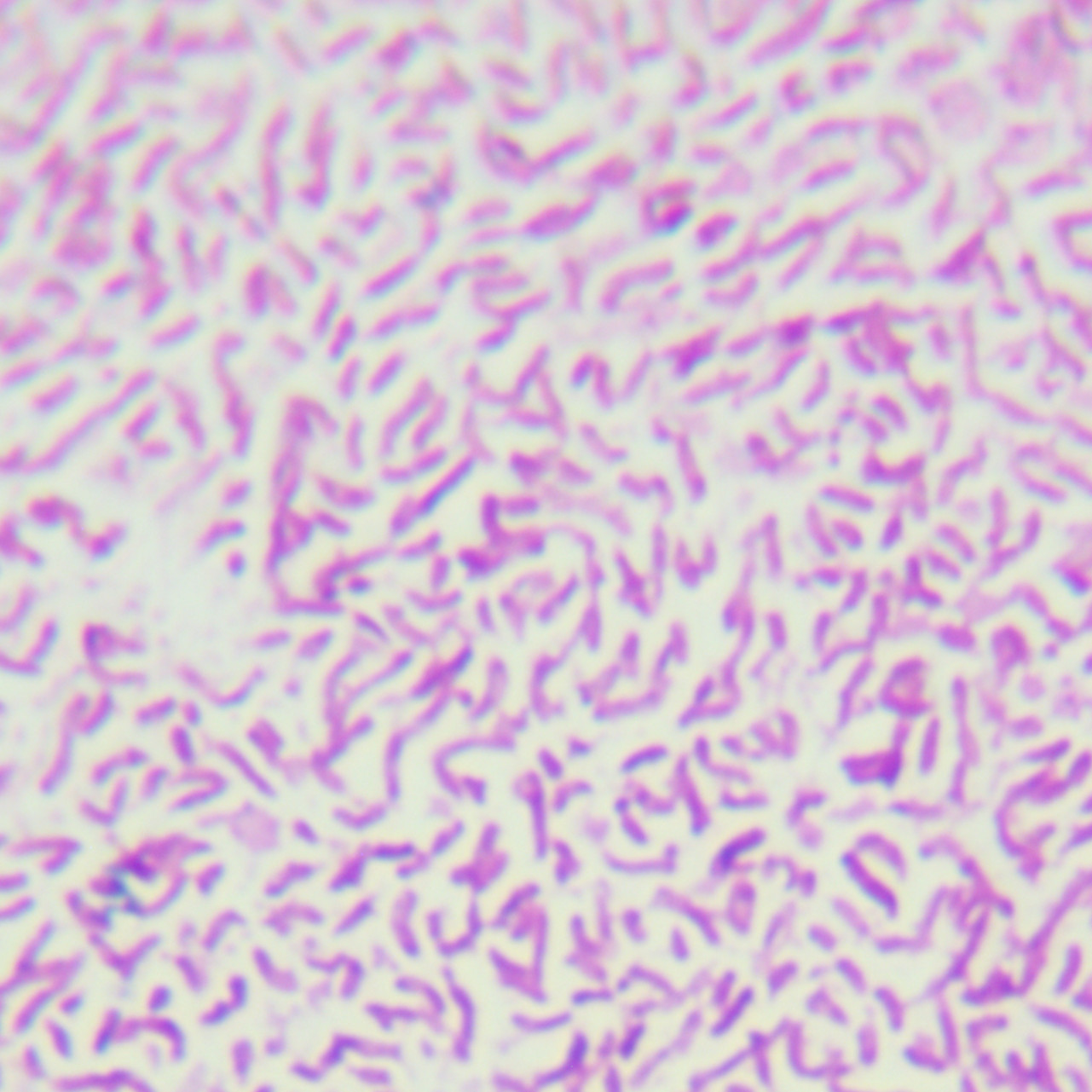 Vibrio vulnificus-BNCC