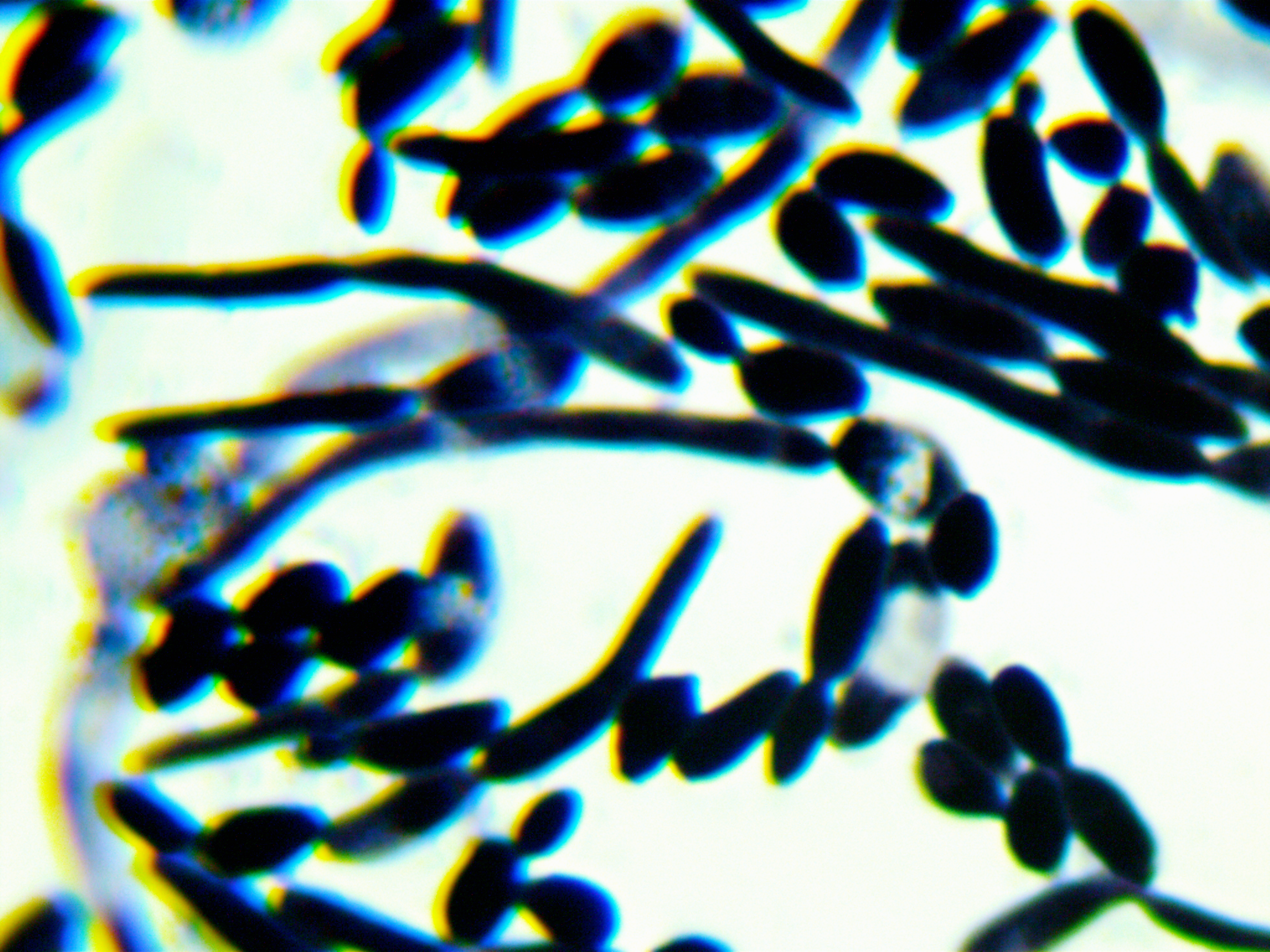 Saccharomyces cerevisiae-BNCC