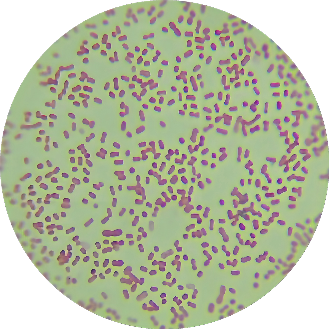 Radiation resistant Acinetobacter-BNCC