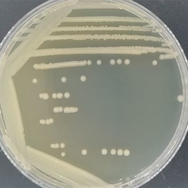 Salmonella Enteritidis subsp. Enteritidis (Typhimurium Typhimurium)-BNCC