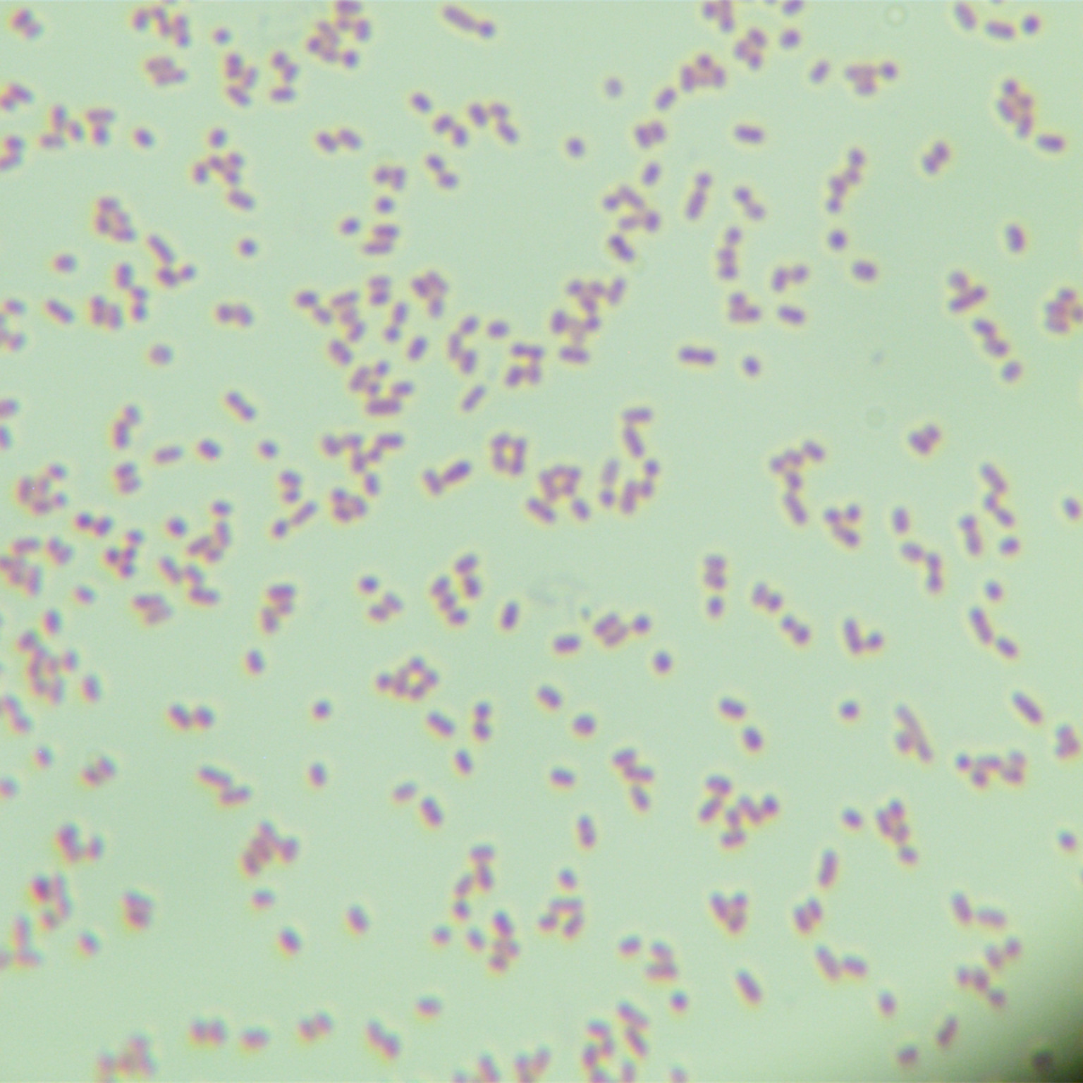Salmonella Enteritidis subsp. Enteritidis (Typhimurium Typhimurium)-BNCC