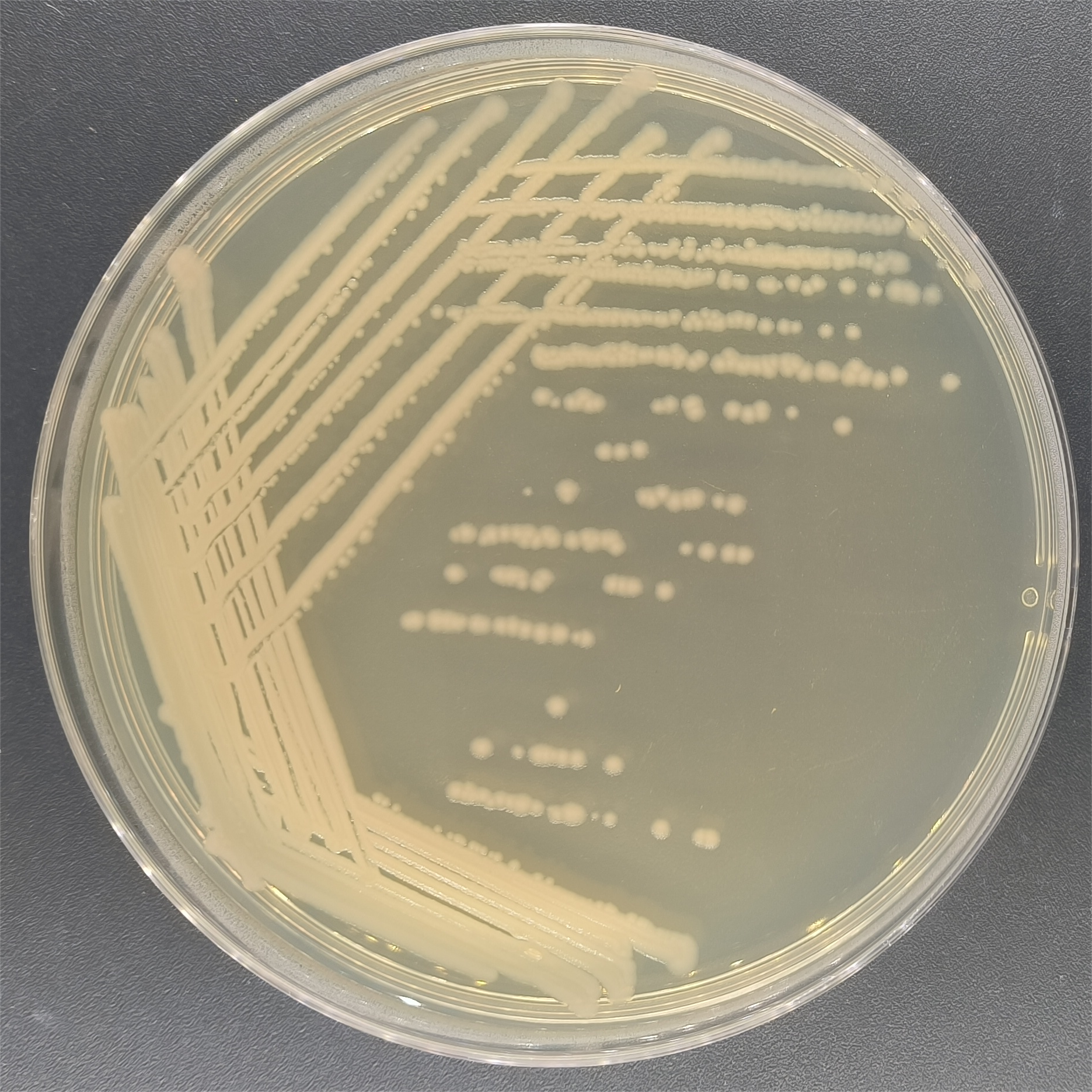 Bacillus lysaeucus-BNCC