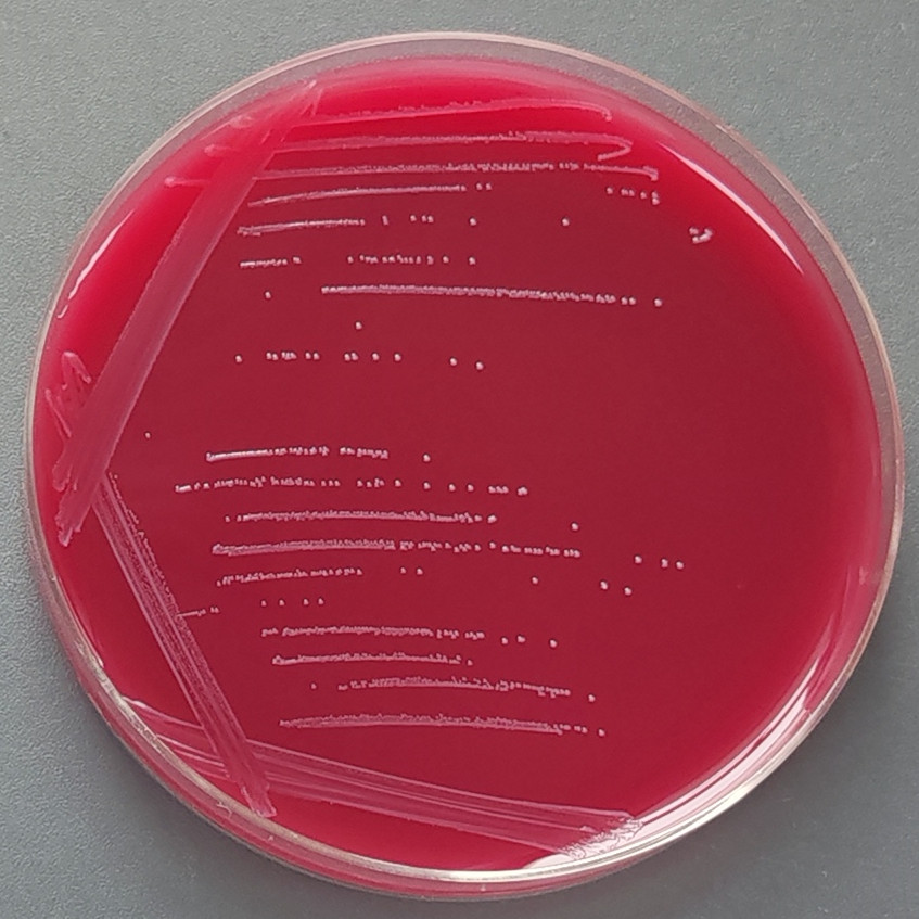 Group B Streptococcus-BNCC