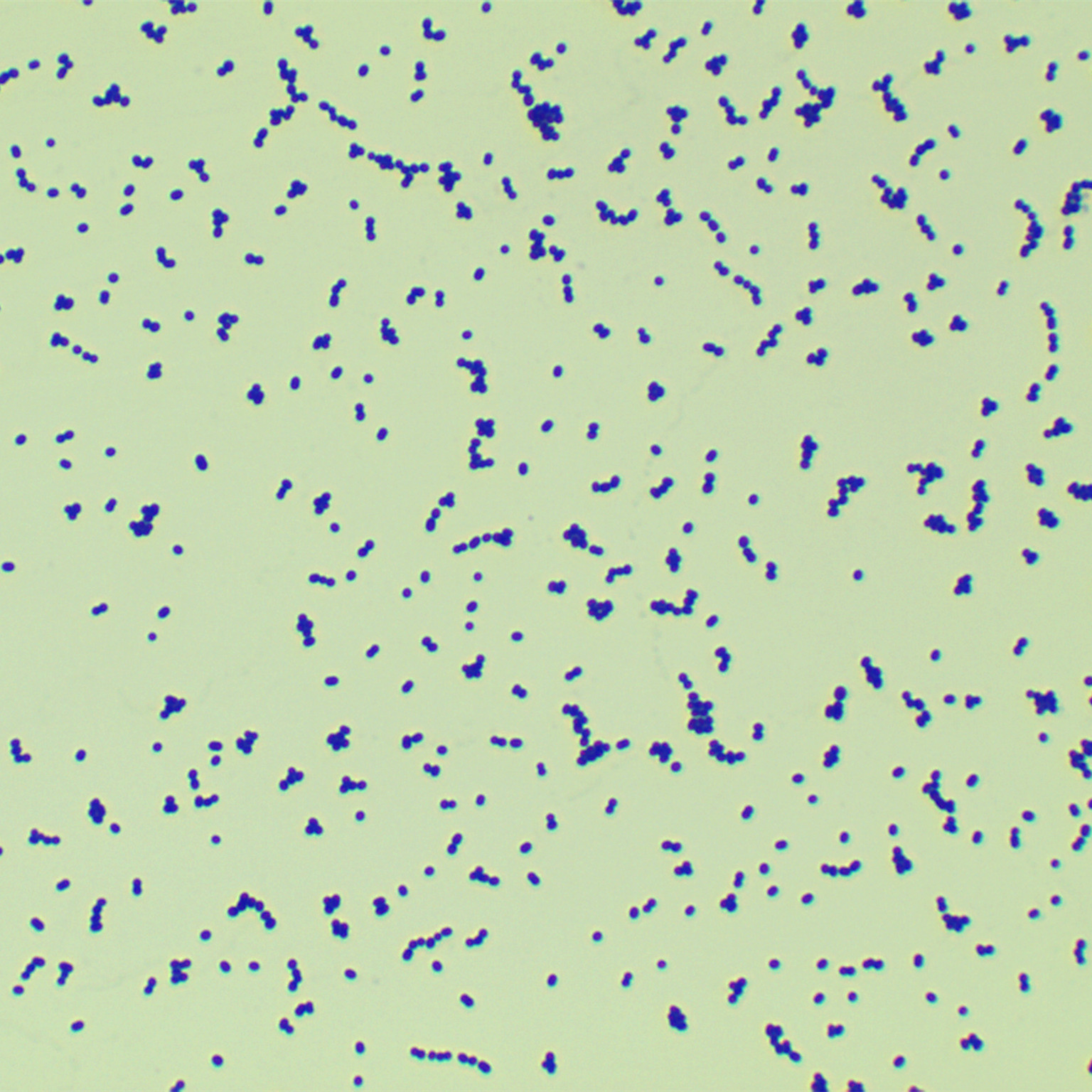 Group B Streptococcus-BNCC