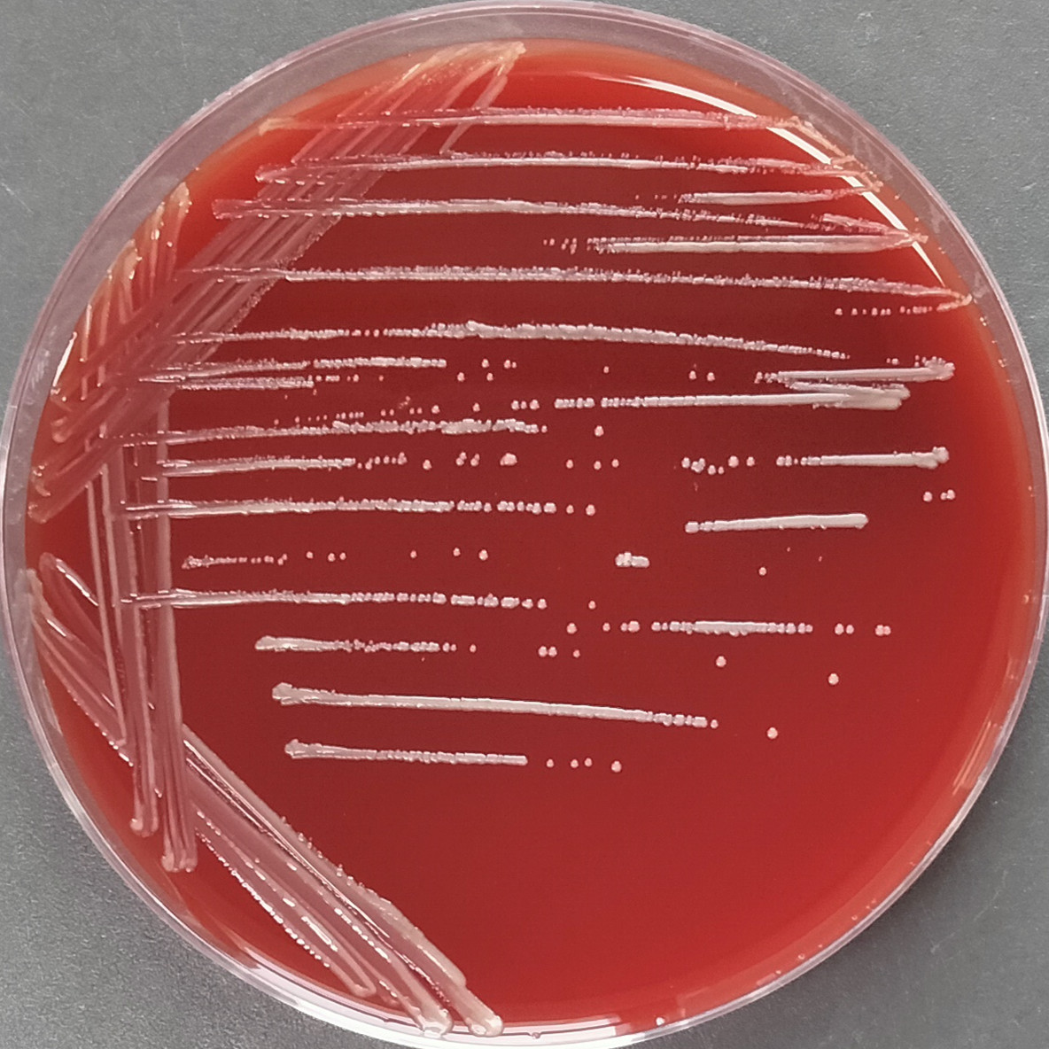 Human heart bacteria-BNCC