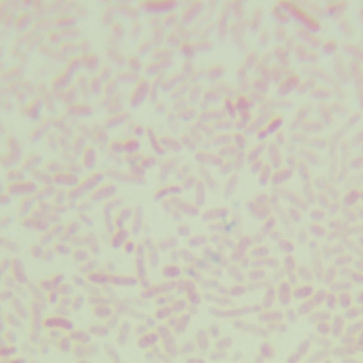 Ureaplasma urealyticum-BNCC