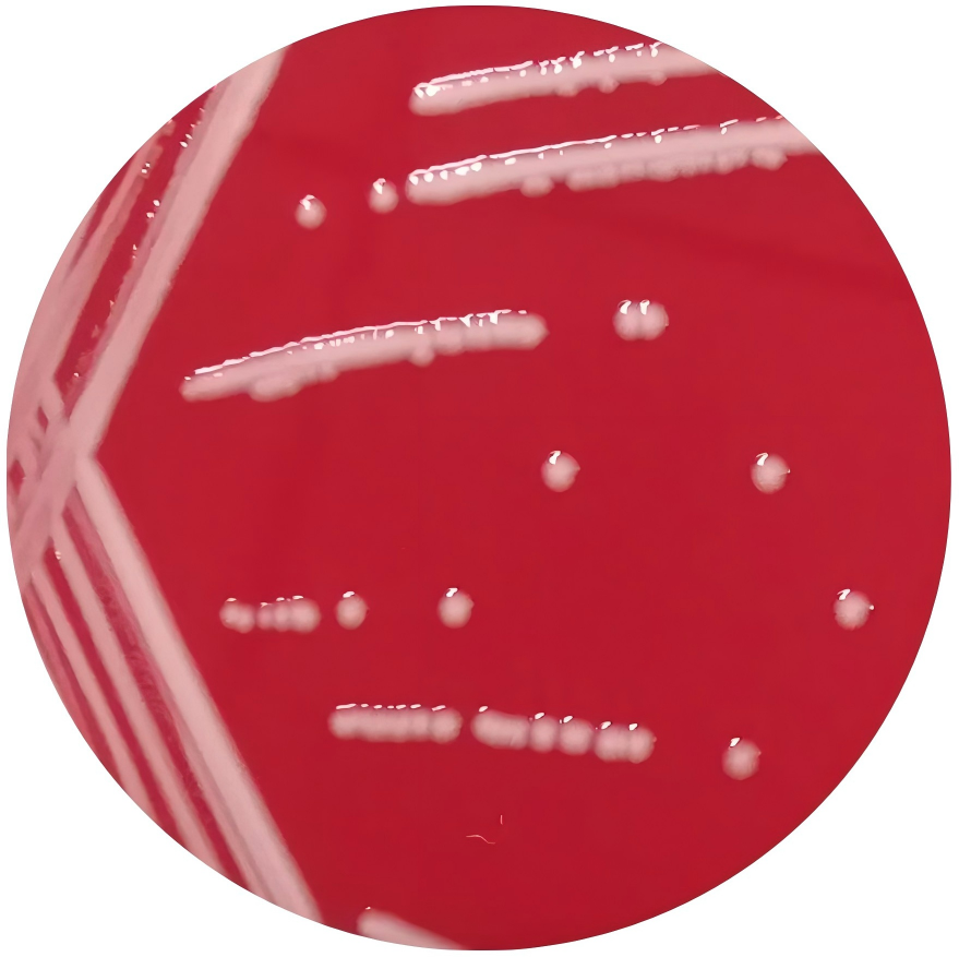 Indian Acinetobacter-BNCC