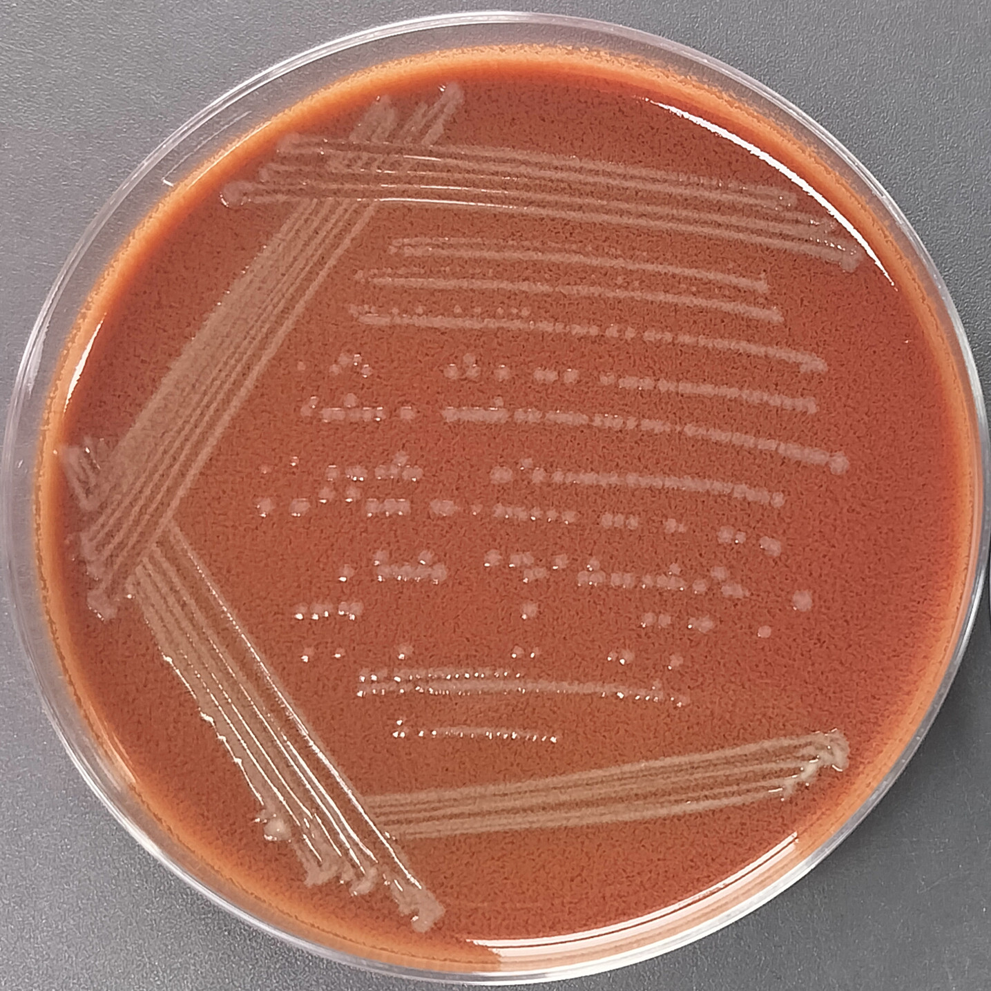 Haemophilus influenzae-BNCC