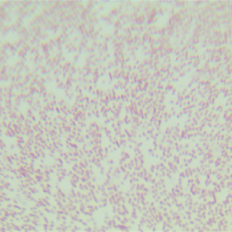 Haemophilus influenzae-BNCC