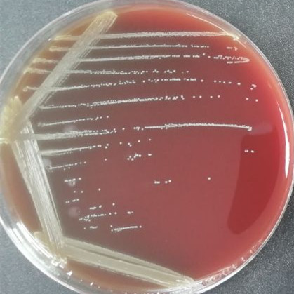 Streptococcus pyogenes A-BNCC