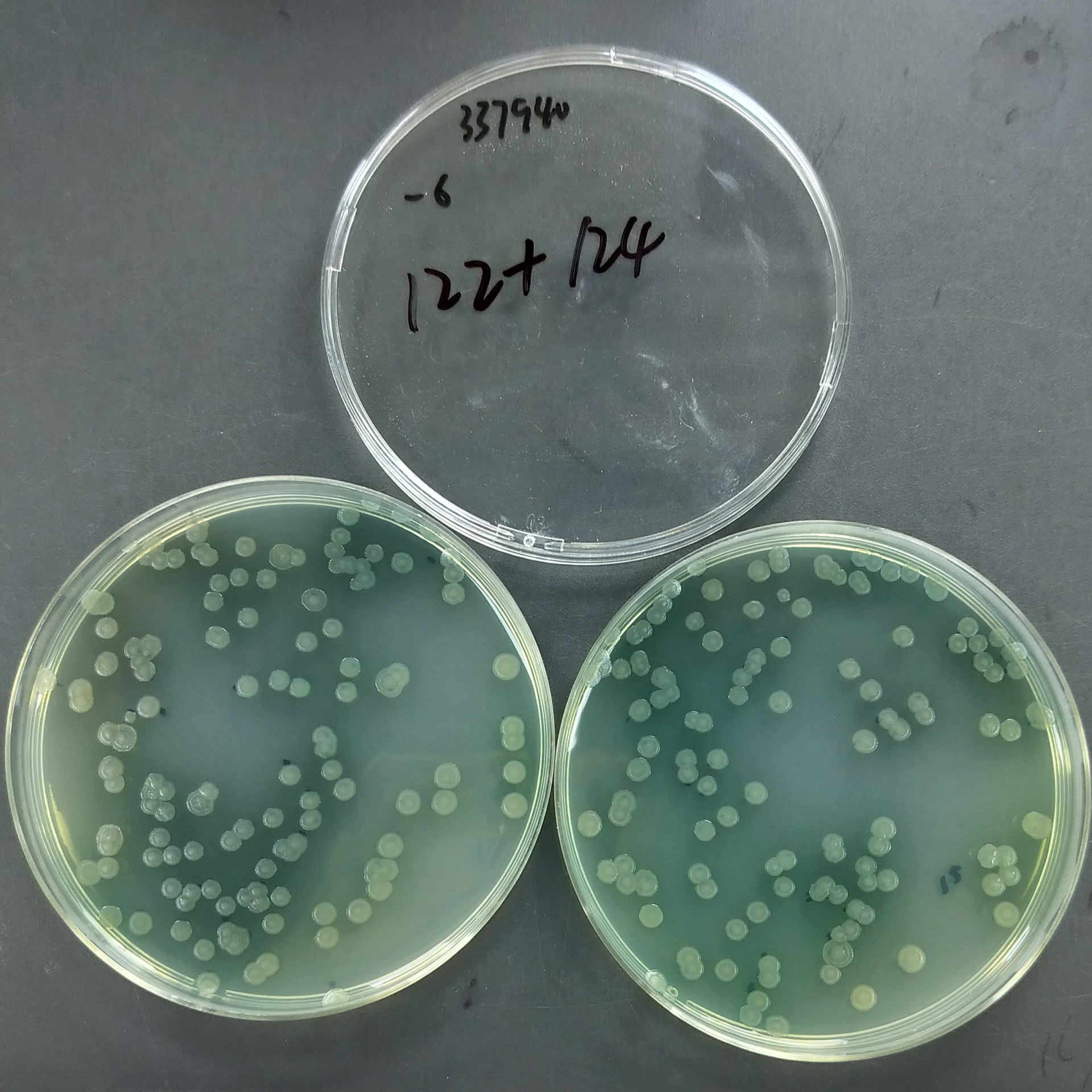 Pseudomonas aeruginosa-BNCC