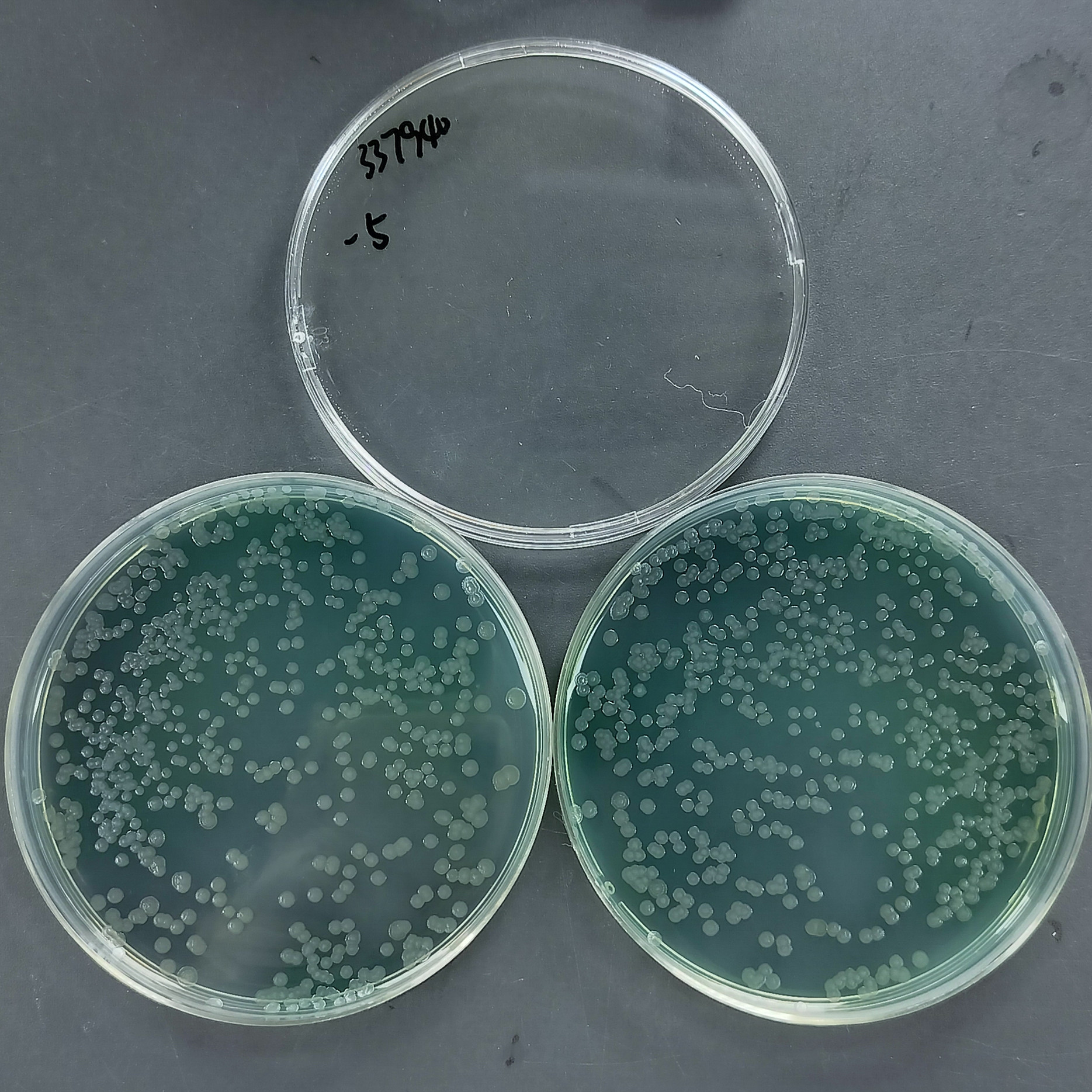 Pseudomonas aeruginosa-BNCC