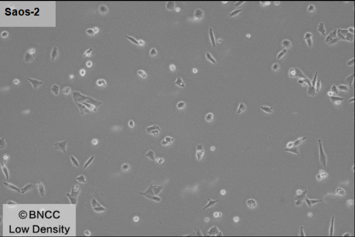 Human osteosarcoma cells-BNCC