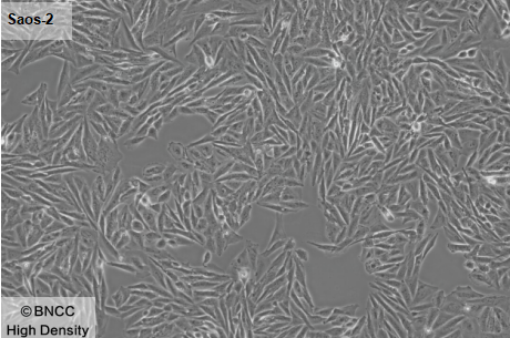 Human osteosarcoma cells-BNCC