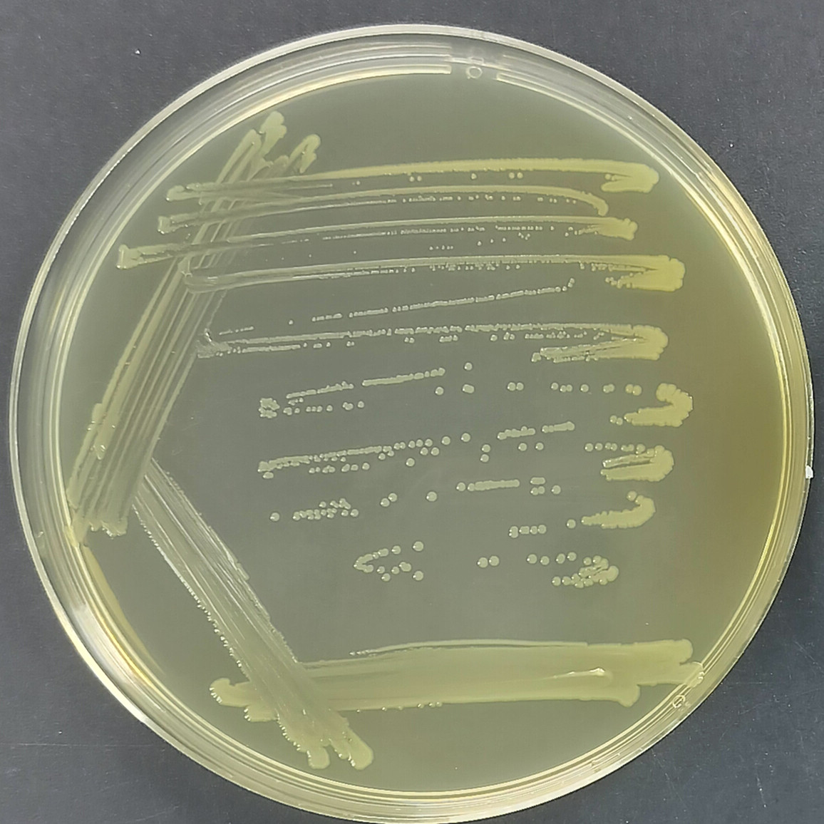 Enterobacter faecalis-BNCC