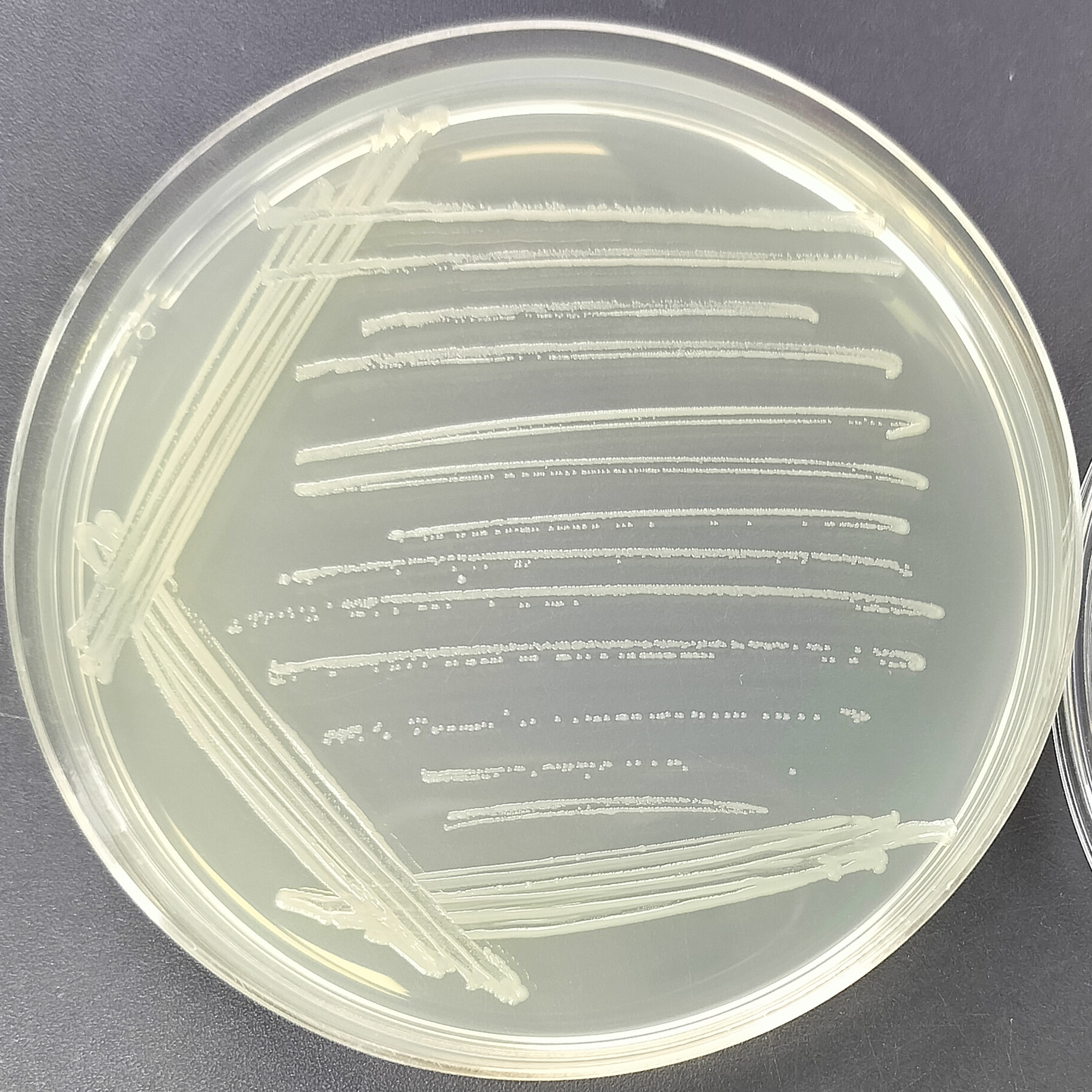 Shigella dysentery-BNCC