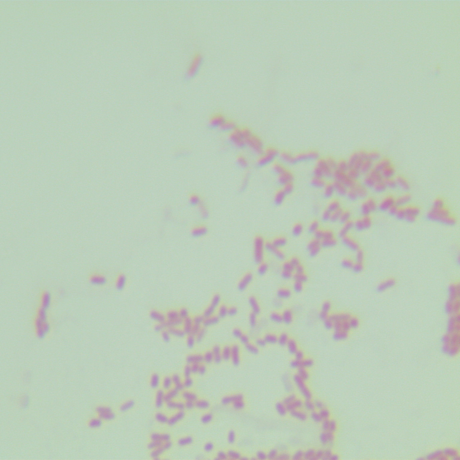 Shigella dysentery-BNCC