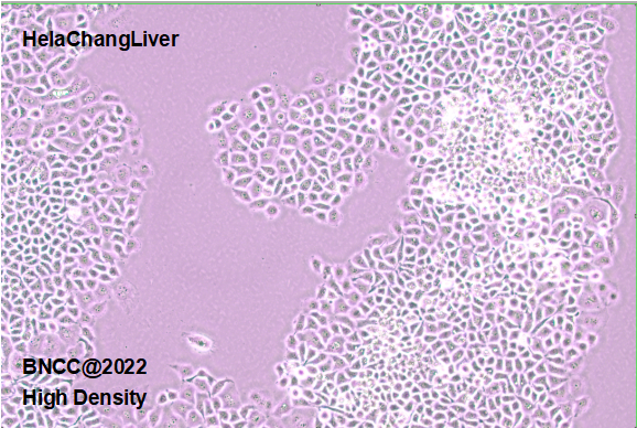 Human cervical cancer cells-BNCC