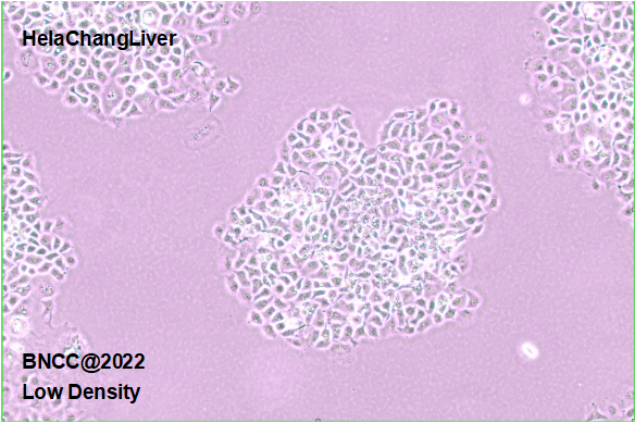 Human cervical cancer cells-BNCC
