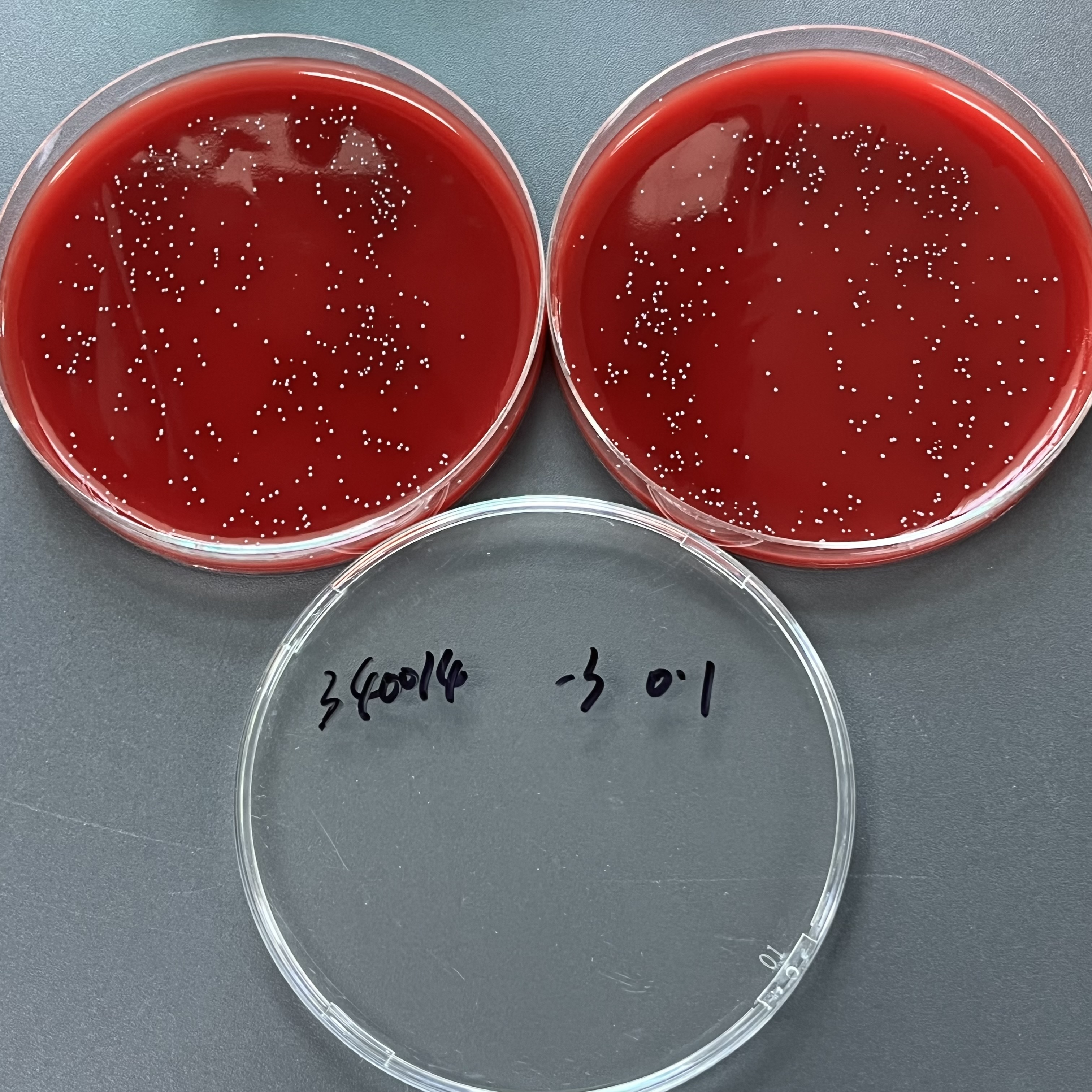 Quantitative strain of Streptococcus agalactiae-BNCC