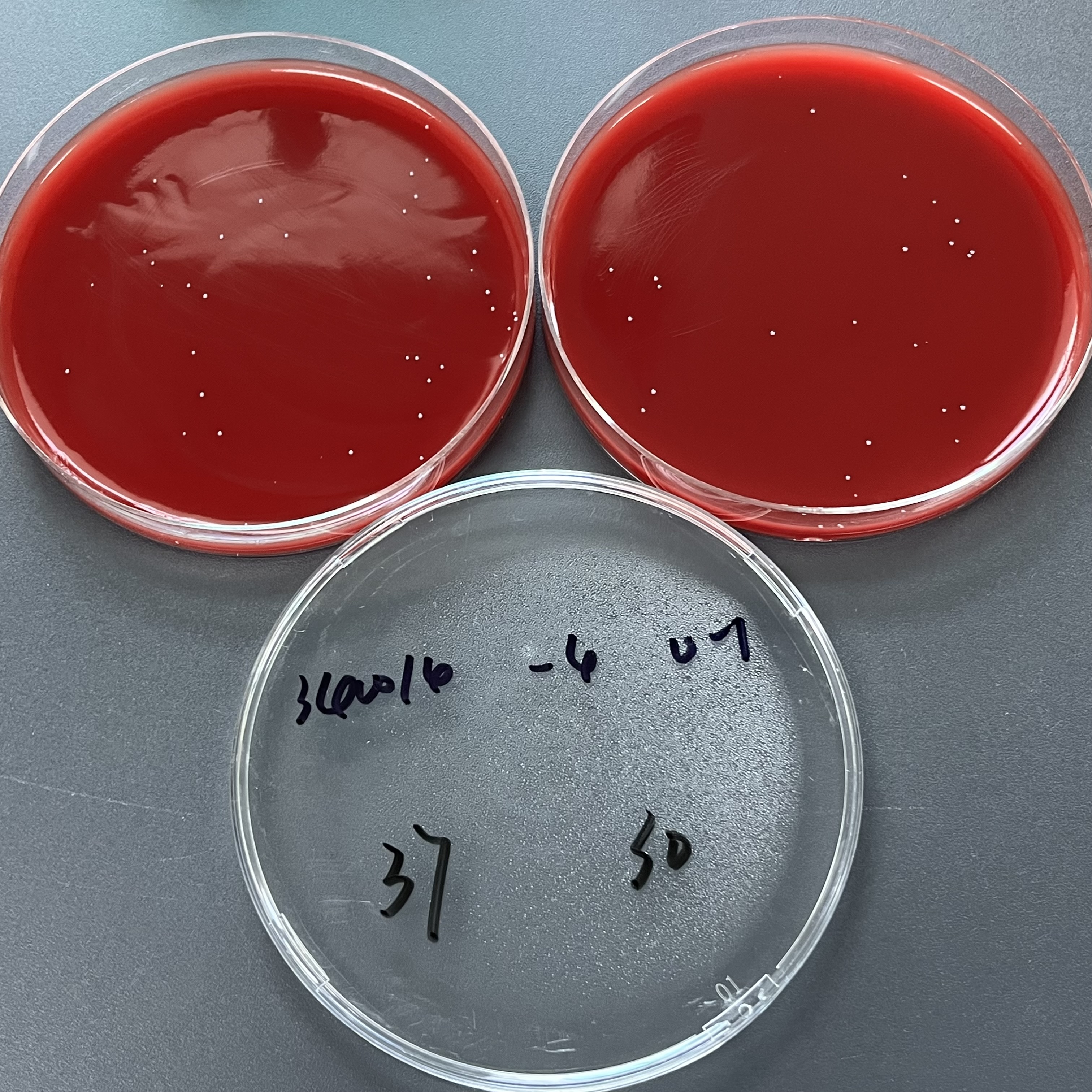 Quantitative strain of Streptococcus agalactiae-BNCC