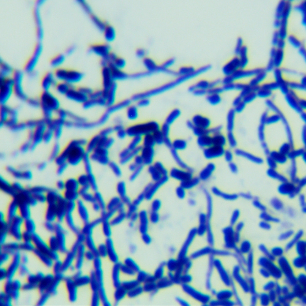 Streptomyces genus-BNCC