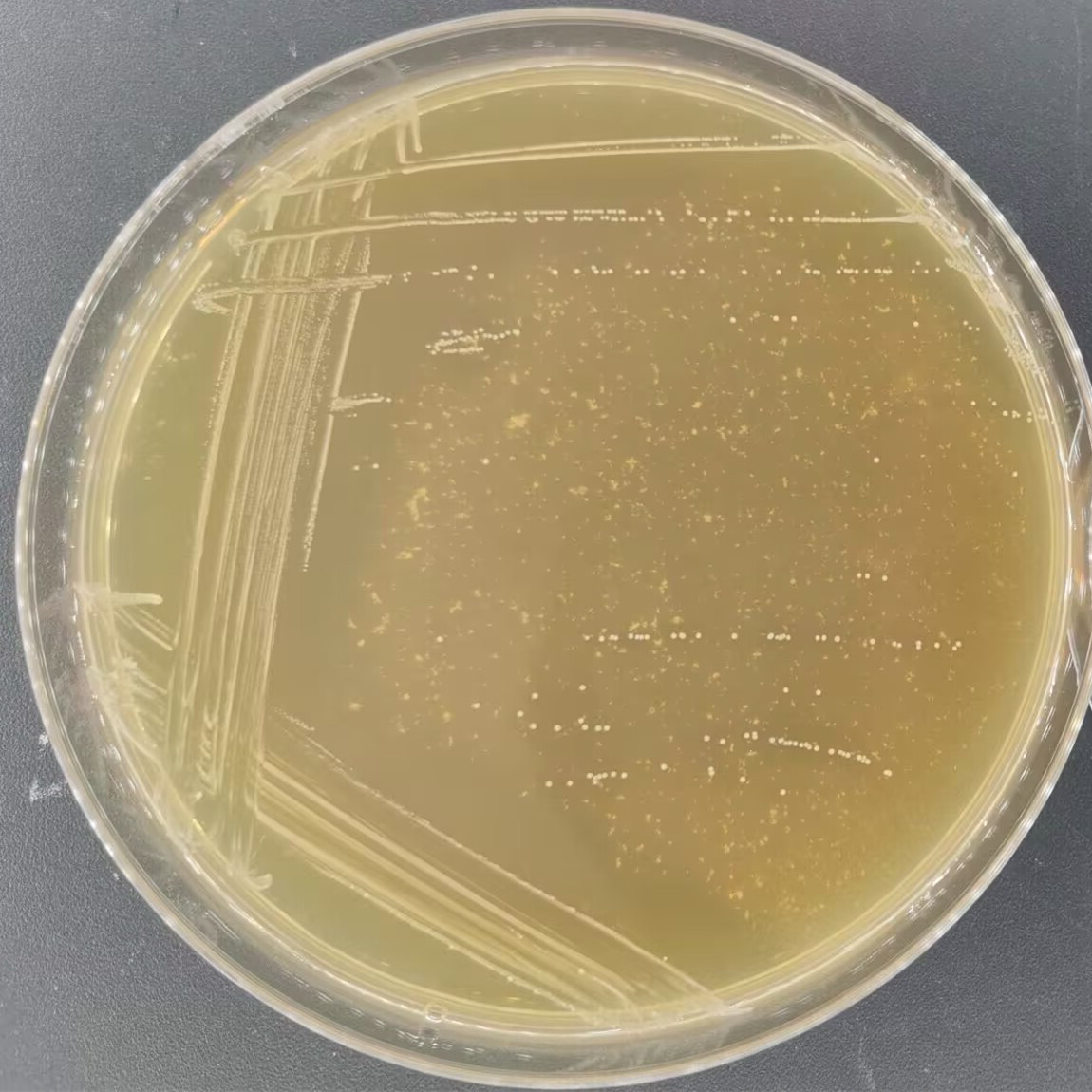 Lactobacillus plantarum-BNCC