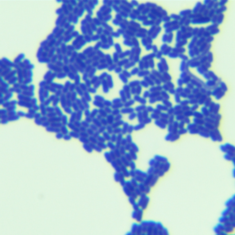 Lactobacillus plantarum-BNCC
