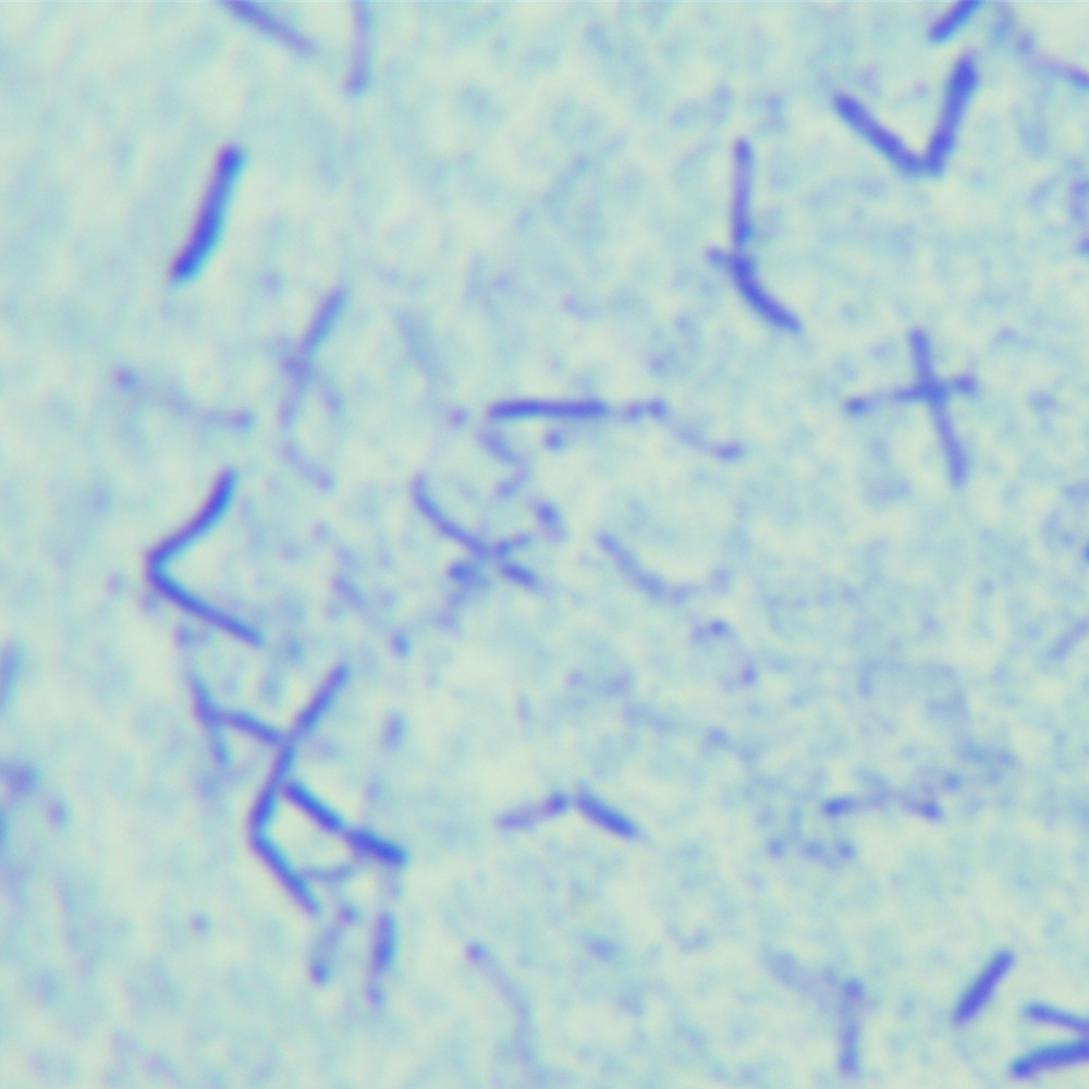 Bacillus subtilis-BNCC