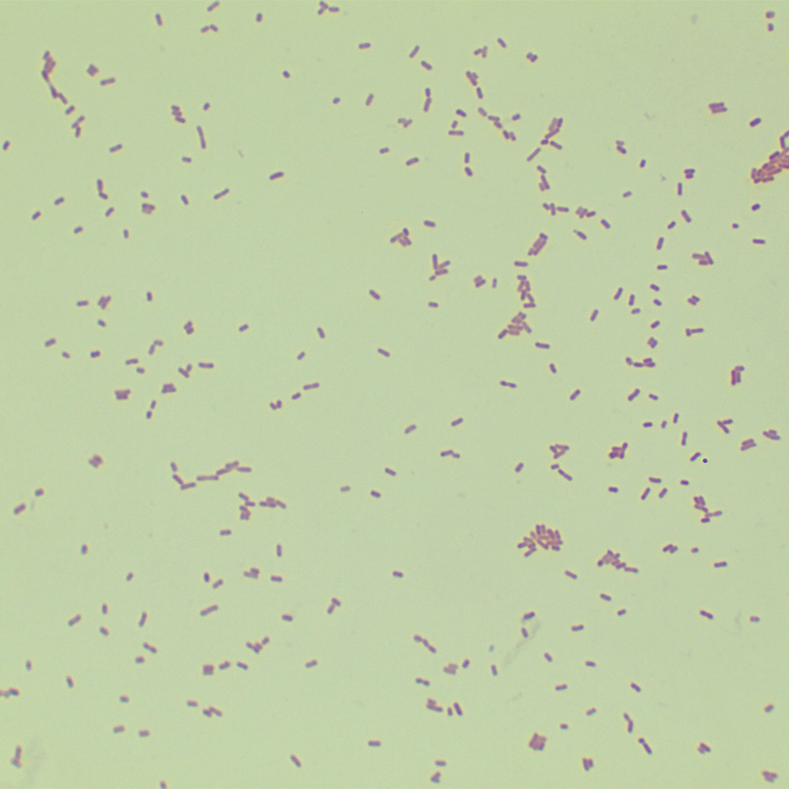 Enteropathogenic Escherichia coli-BNCC