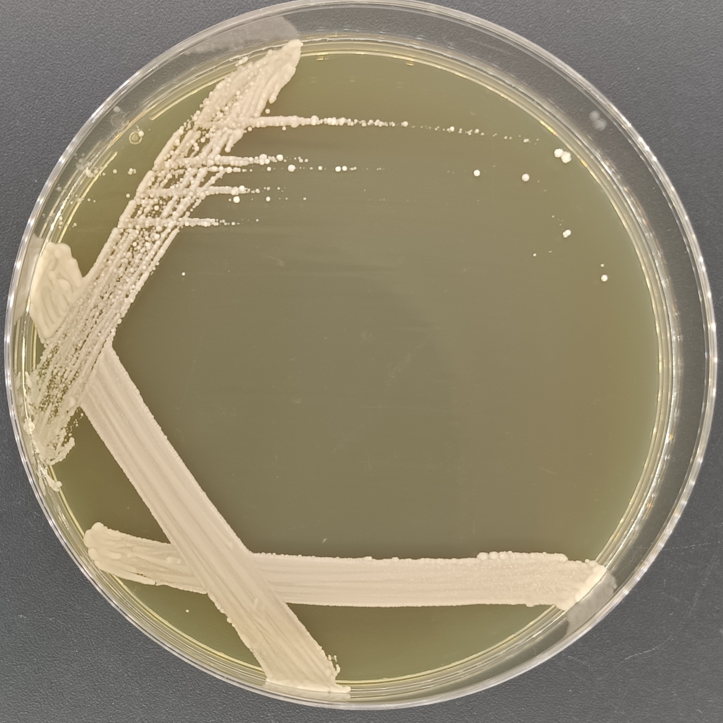 Fruit borne Mayer's yeast-BNCC