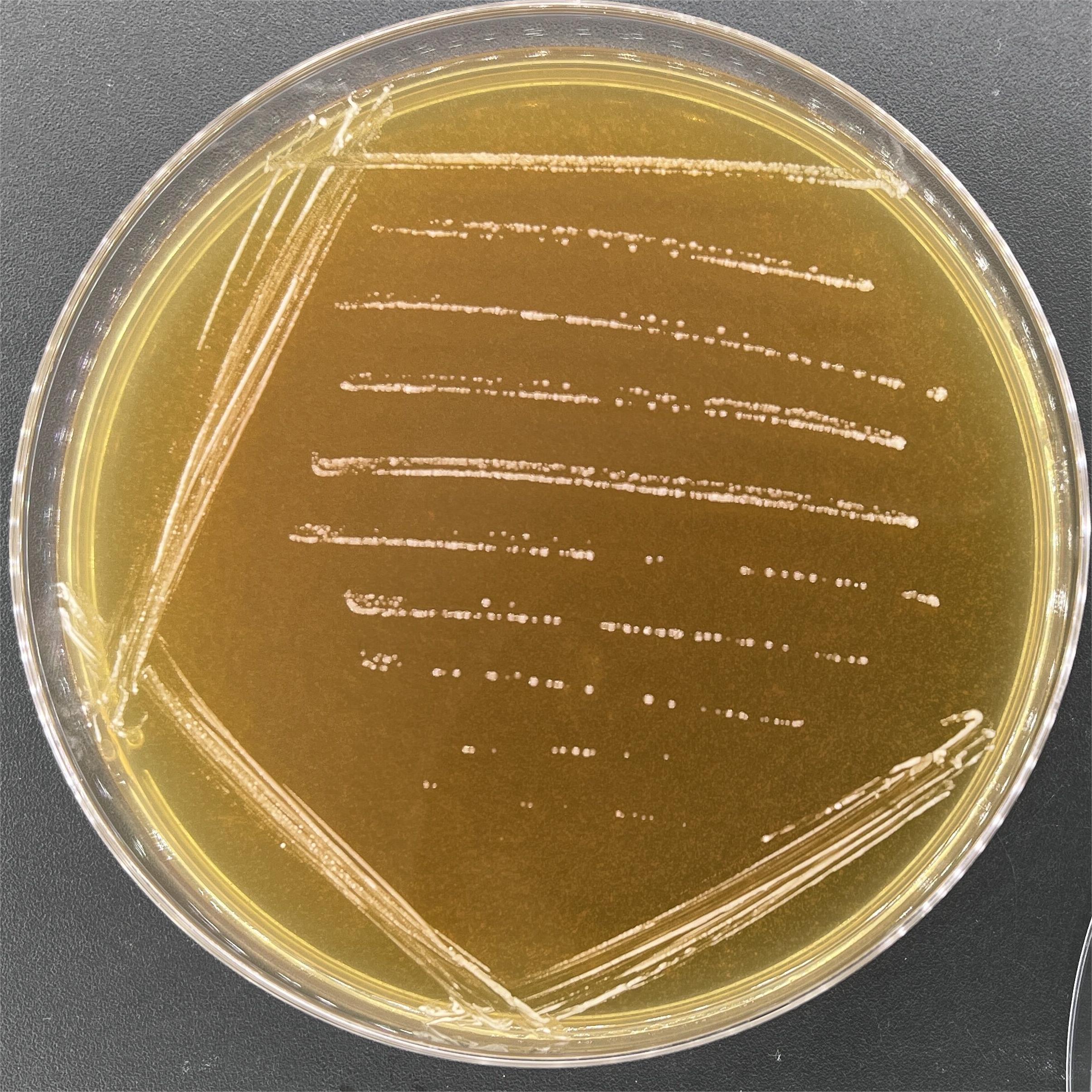 Bifidobacterium longum subsp. infantis-BNCC