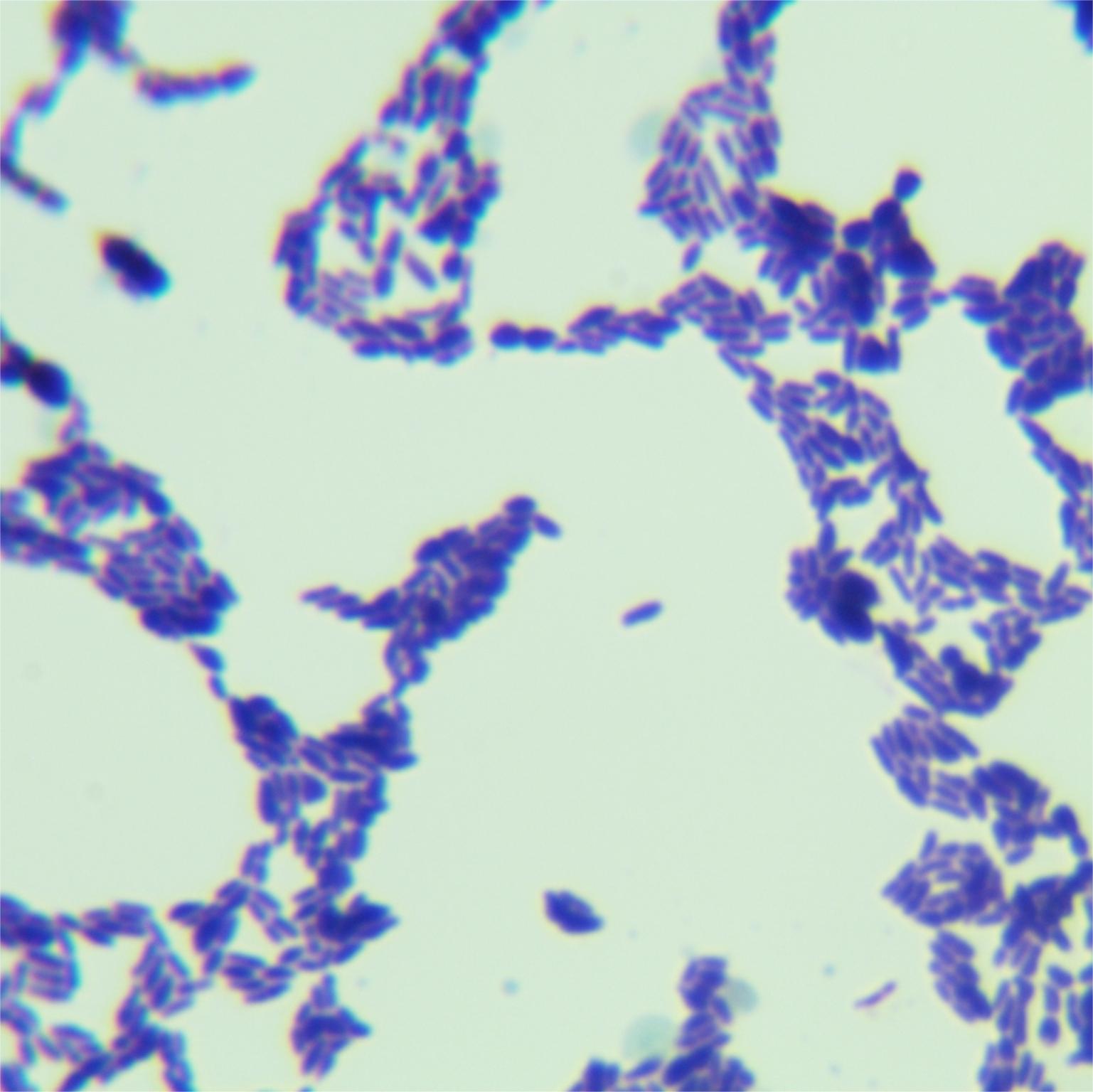 Bifidobacterium longum subsp. infantis-BNCC