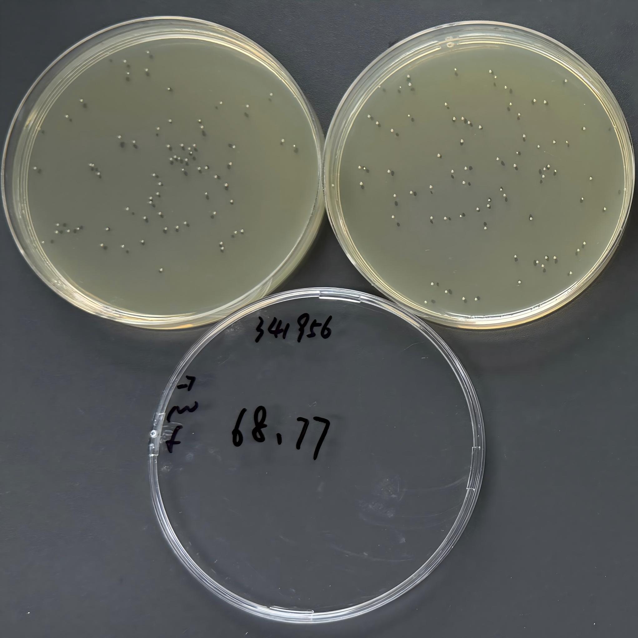 Escherichia coli-BNCC