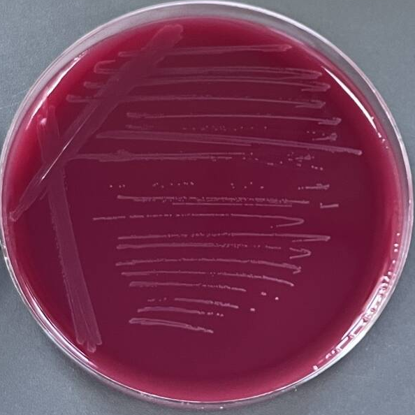 Escherichia coli-BNCC