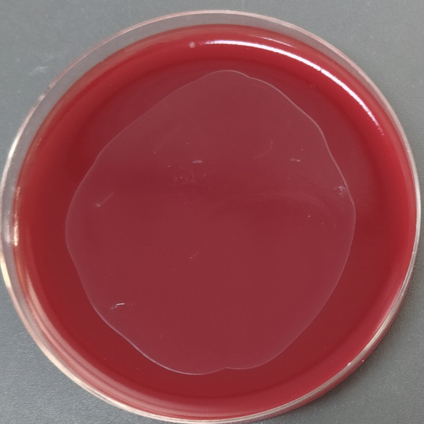 Fecal pseudomonas-BNCC