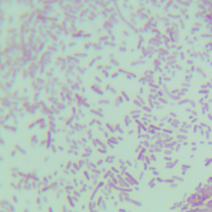 Fecal pseudomonas-BNCC