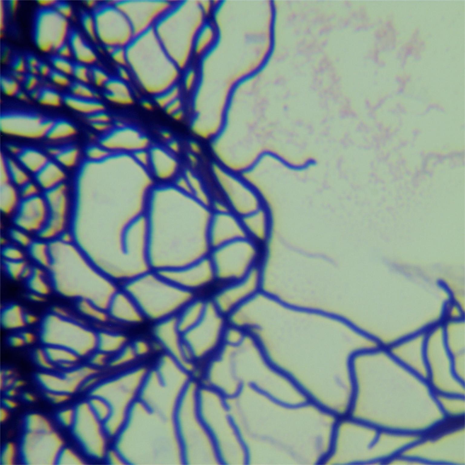 Filamentous Streptomyces-BNCC